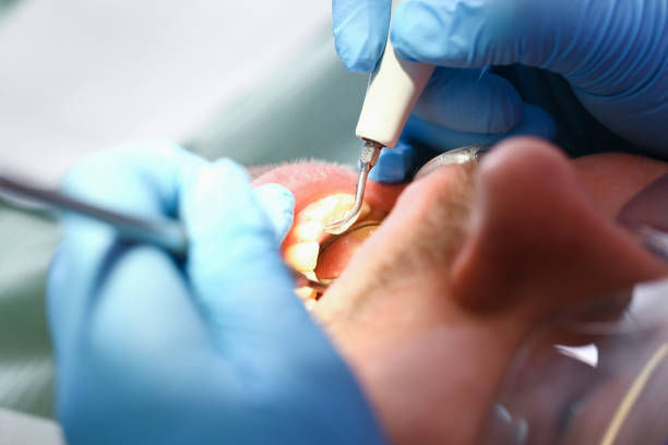 Best Emergency Broken Tooth Repair in Monroe, WI