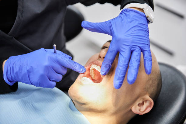 Best Emergency Wisdom Teeth Removal in Monroe, WI